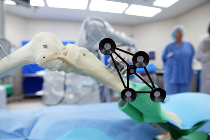 MAKOplasty robot arm